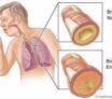 Comment-sont-faits-nos-bronches-et-nos-poumons?