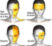 Algies vasculaires de la face